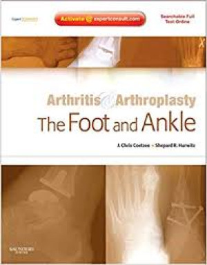Image of Arthritis & Arthroplasty: The Foot and Ankle